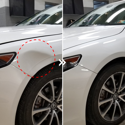 DentFix™ - Auto Dellenentferner