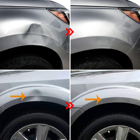 DentFix™ - Auto Dellenentferner