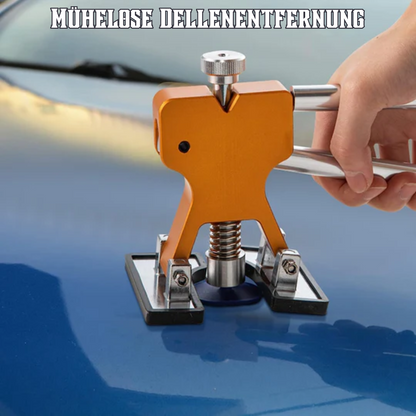 DentFix™ - Auto Dellenentferner