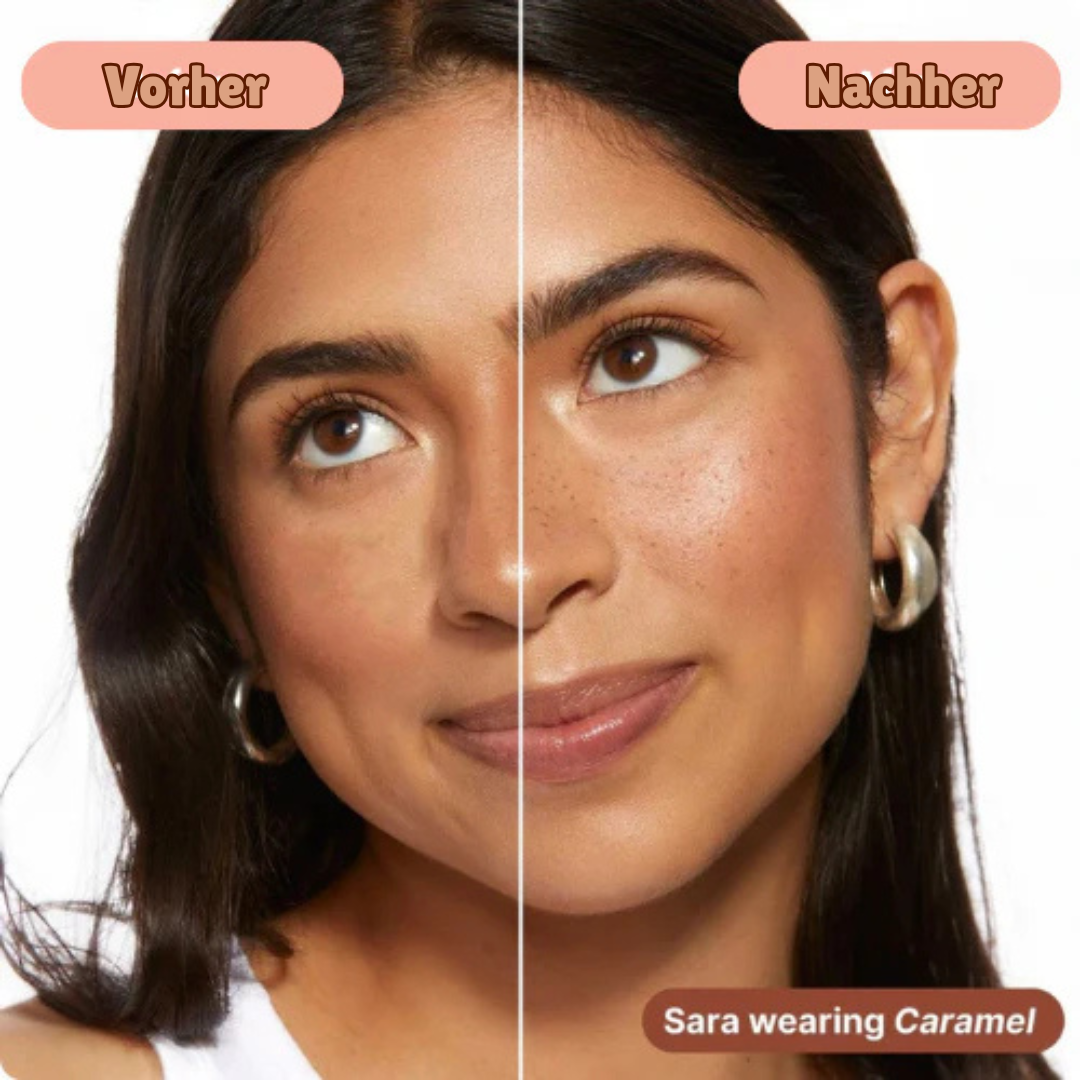 Frekka™ – Sommersprossen Stempel (1+1 GRATIS)