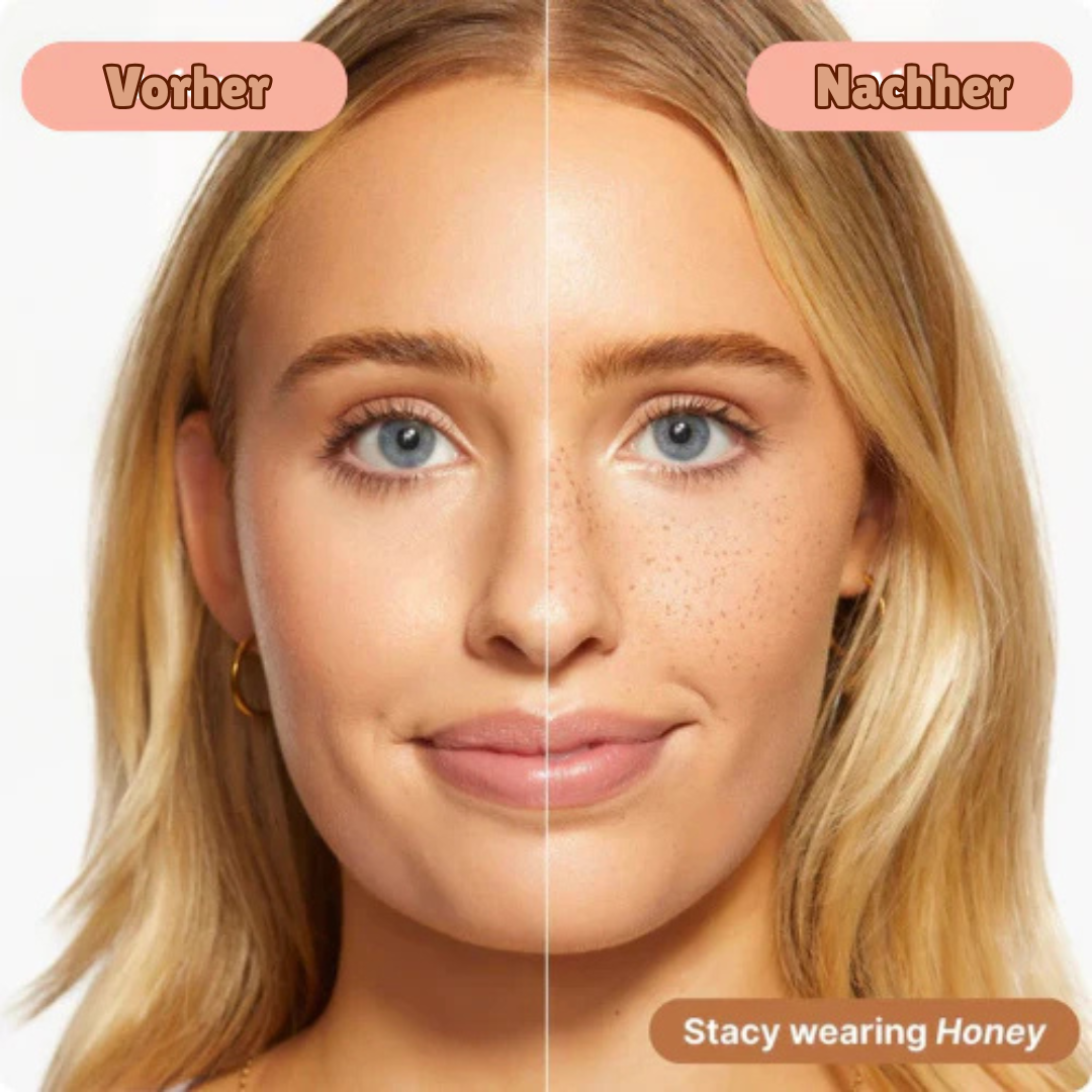 Frekka™ – Sommersprossen Stempel (1+1 GRATIS)